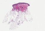 Dermatopathology (DPATH) 