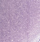 Peripheral Blood Smear, Expanded (EHE1)