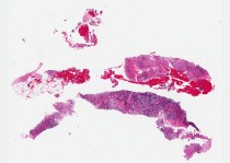 Practicum in Cancer Surgical Pathology (PCSP)